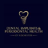 dentalimplantsroc